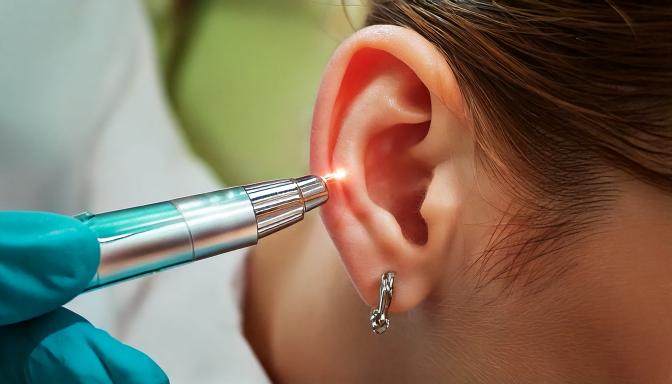 Image lasérotherapie